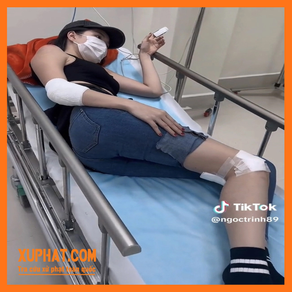 Ngọc Trinh đăng tải những hình ảnh về tai nạn sau khi điều khiển xe mô tô nguy hiểm (Ảnh: cắt từ clip)